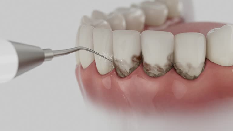 Trusted Dental Implants service in Grand Bay, AL - Dentist Open Now